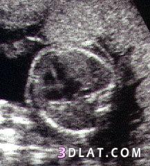 رد: مراحل تطور الجنين داخل بطن أمه بالصور  