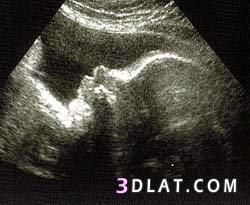 رد: مراحل تطور الجنين داخل بطن أمه بالصور  